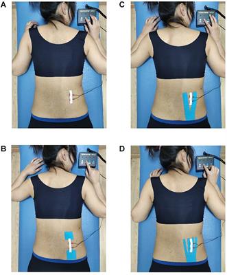 Effect of Different Kinesio Taping Interventions on the Local Thresholds of Current Perception and Pressure Pain in Healthy Adults